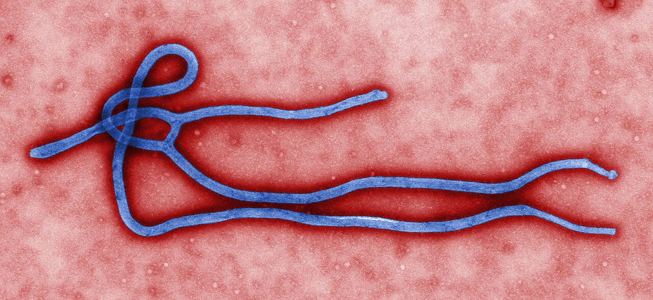 Ebola virus virion. Created by GC microbiologist Cynthia Goldsmith, this colorized transmission electron micrograph (TEM) revealed some of the ultrastructural morphology displayed by an Ebola virus virion.